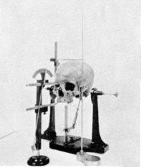 200px-Craniometry_skull_1902