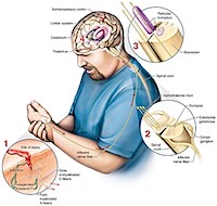 pain-pathways
